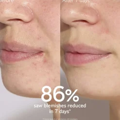 Caudalie Vinopure Natural Salicylic Acid Pore Minimising Serum 30ml Discount
