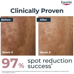 Eucerin Anti-Pigment Dual Serum 30ml Clearance