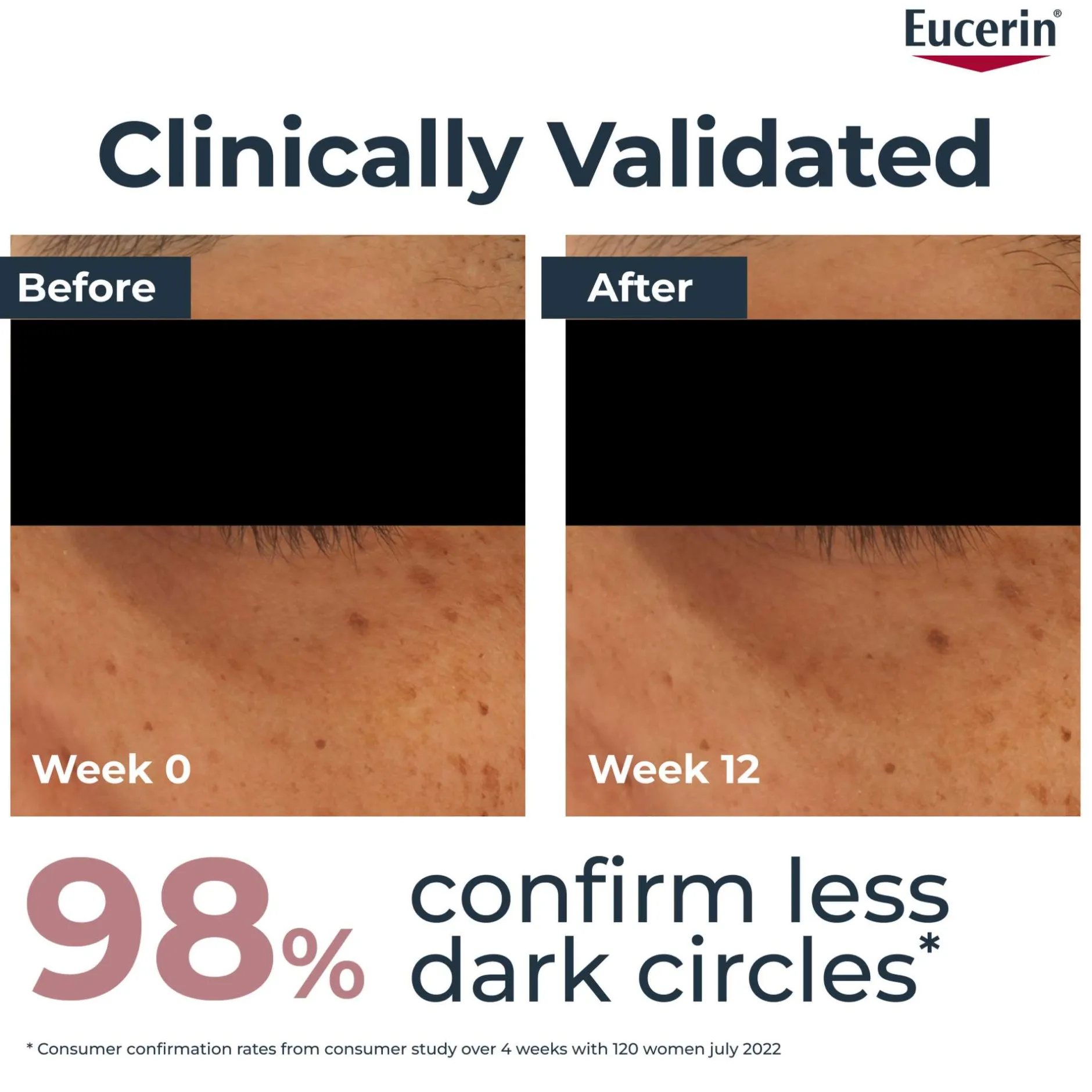 Eucerin Anti-Pigment Illuminating Eye Cream 15ml Sale