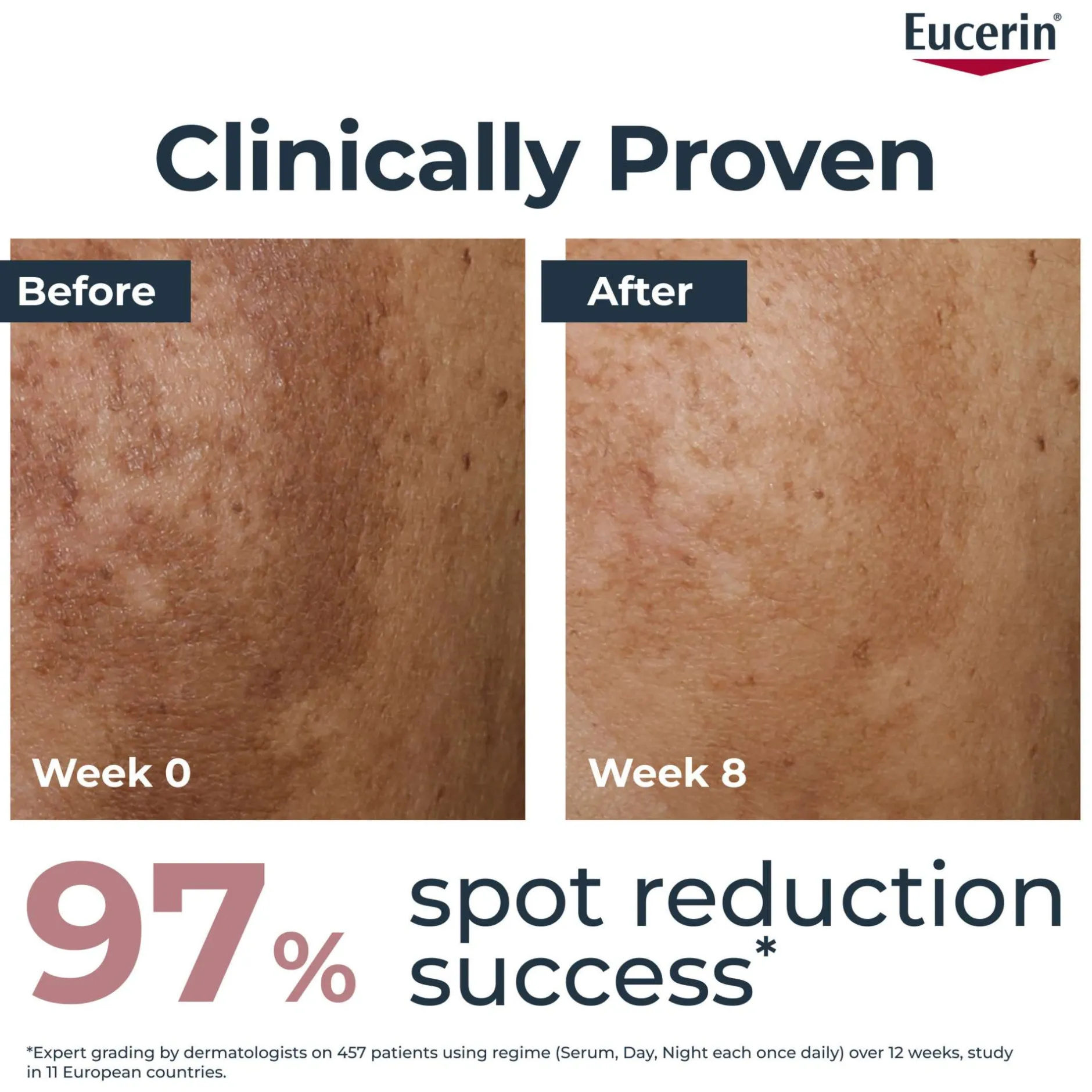 Eucerin Anti-Pigment Night Cream 50ml Outlet
