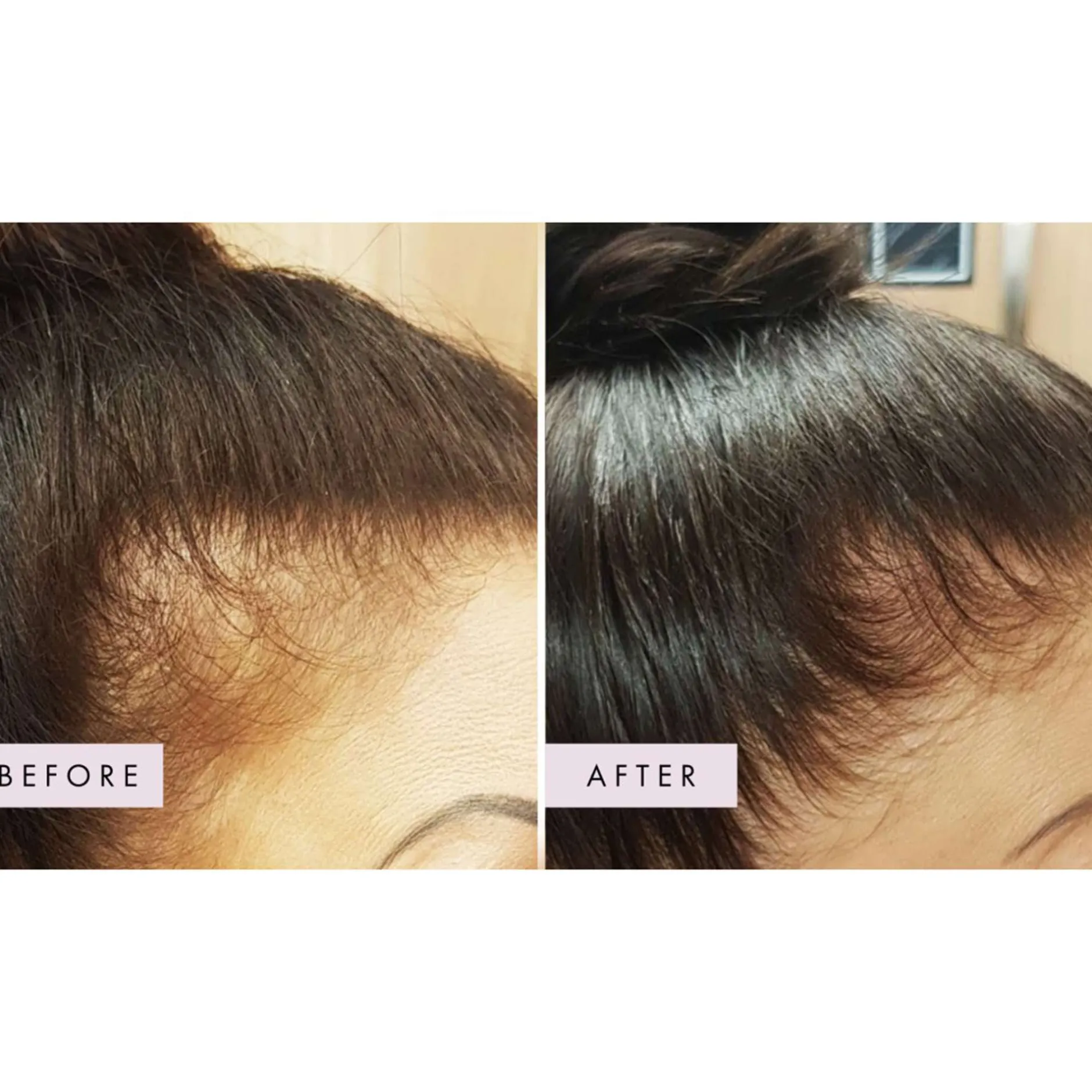 Hair Gain Gummies 1 Month Supply x 60 Gummies Best