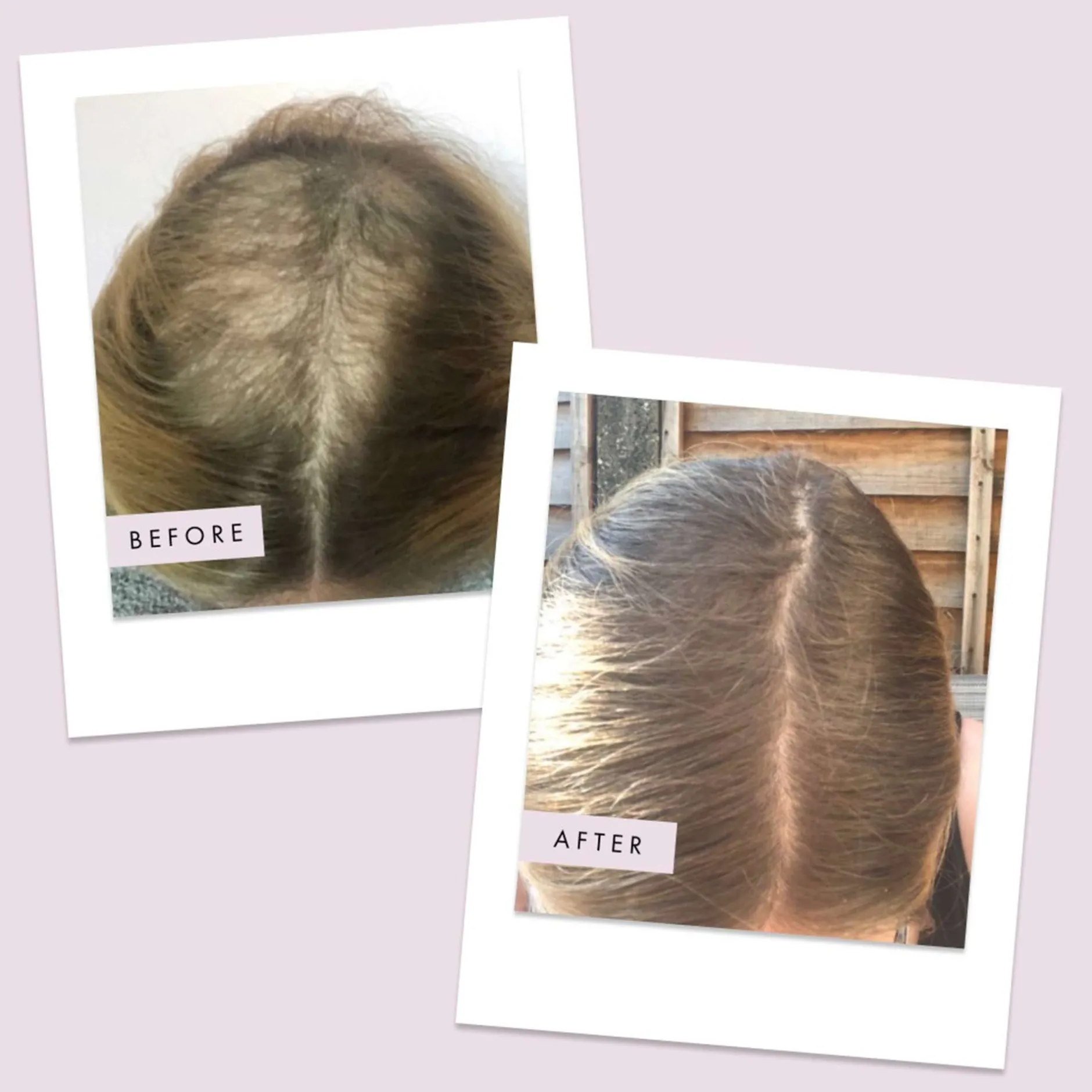 Hair Gain Hair Capsules 1 Month Supply x 60 Capsules Online