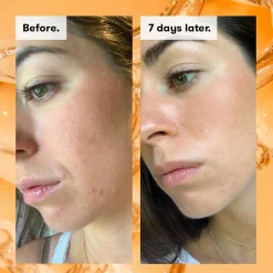 REN Clean Skincare Face Ready Steady Glow Daily AHA Tonic 250ml / 8.5 fl.oz. Discount